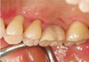 �uP-10M�v�Ńu���b�V���O��
