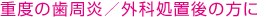 �d�x�̎������^�O�ȏ��u��̕���
