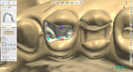 Dental DesignerTM
