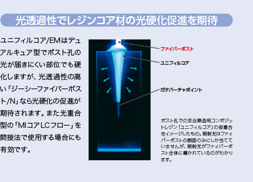 光透過性でレジンコア材の光硬化促進を期待