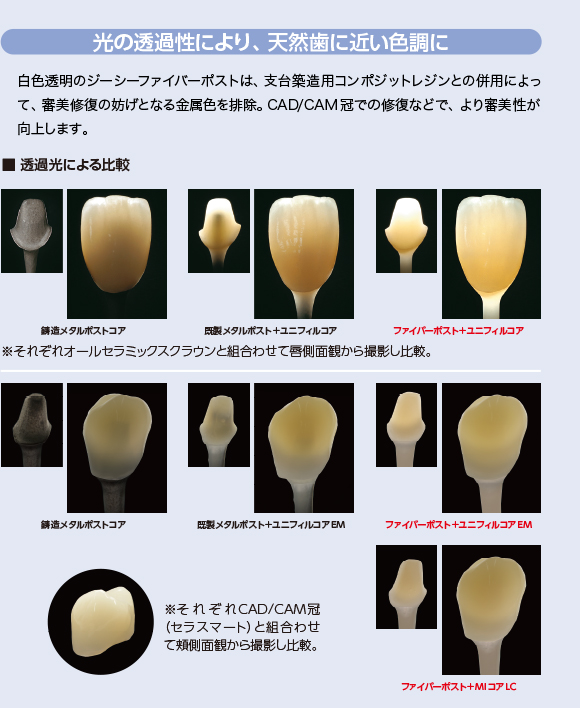 光の透過性により、天然歯に近い色調に