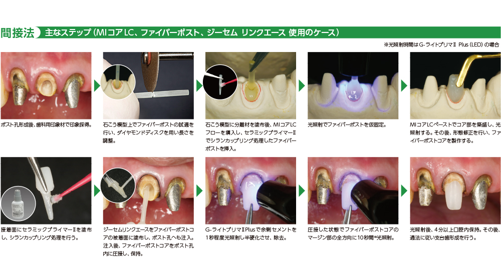 ジーシー レジンコア　システム　間接法