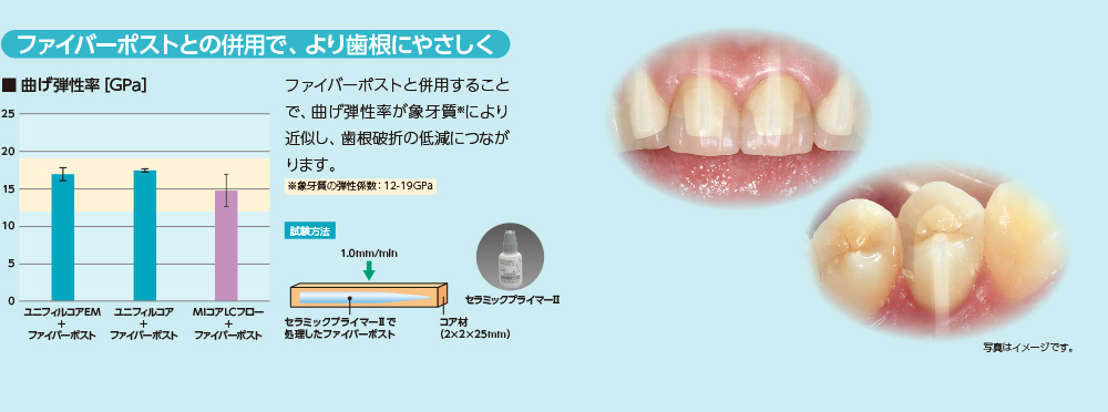 ファイバーポストとの併用で、より歯根にやさしく