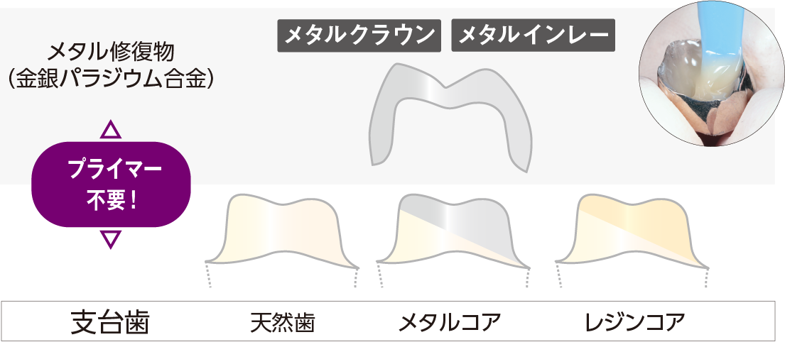 プライマー不要　メタルクラウン