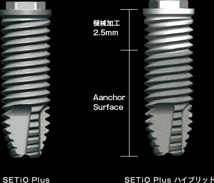 Dual Surface Treatment