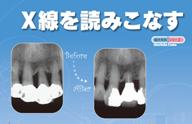 【体験版】X線を読みこなす