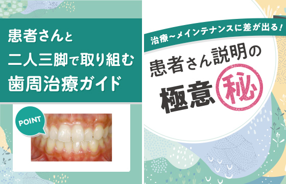 【体験版】患者さんと二人三脚で取り組む歯周治療ガイド／
患者さん説明の極意（秘）