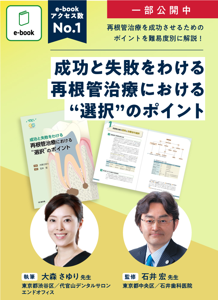 成功と失敗をわける再根管治療における”選択”のポイント