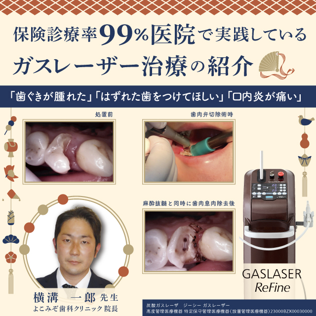 【GC Webセミナー Live】保険診療率99%医院で実践している ガスレーザー治療の紹介