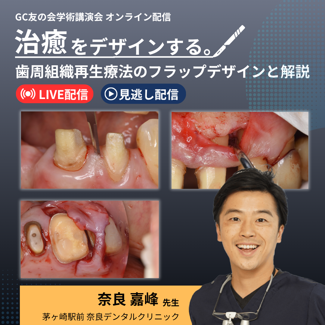 治癒をデザインする。歯周組織再生療法のフラップデザインと解説