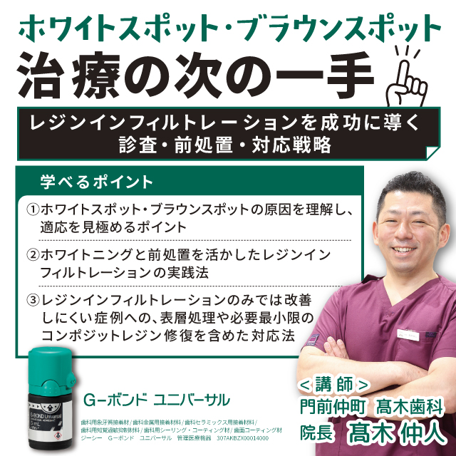 【GC WebセミナーLIVE】ホワイトスポット・ブラウンスポット治療の次の一手