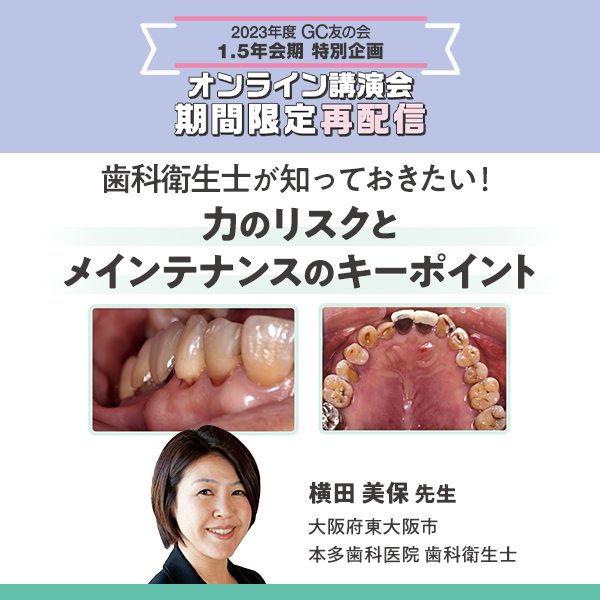 歯科衛生士が知っておきたい！ 力のリスクとメインテナンスのキーポイント