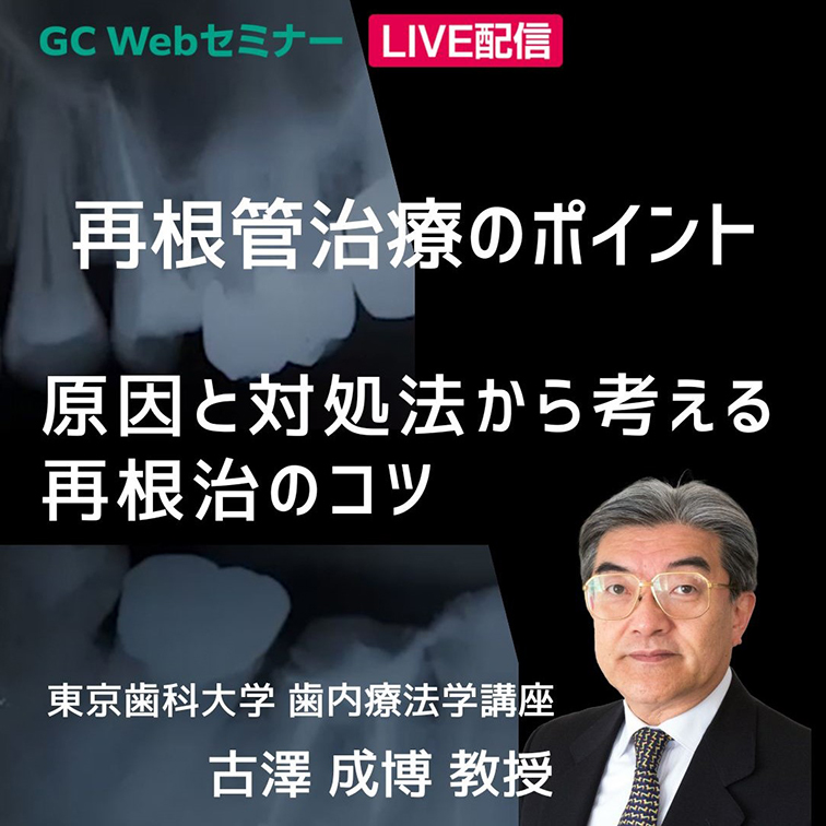 GC WebセミナーLive 再根管治療のポイント