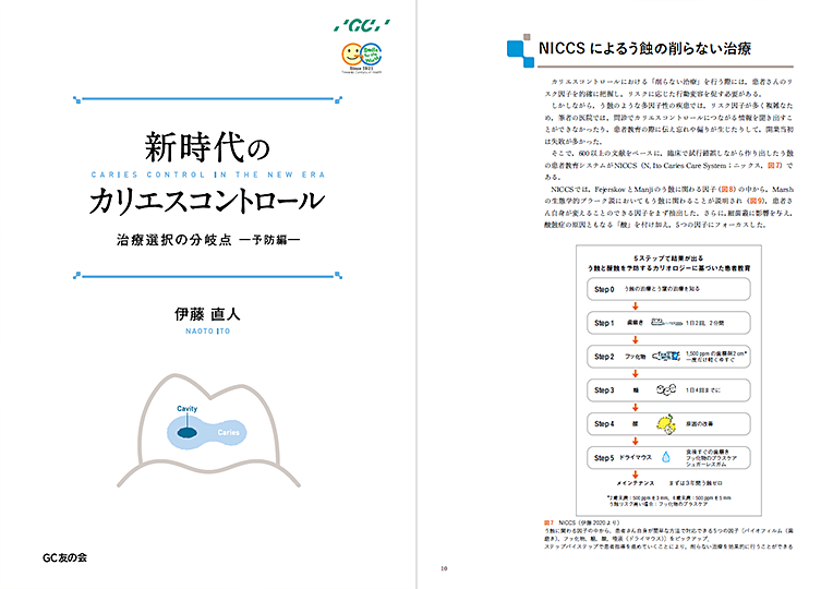新時代のカリエスコントロール　治療選択の分岐点 －予防編－