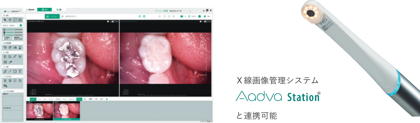 Ｘ線画像管理システム Aadva Station® と連携可能