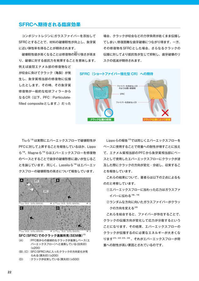 直接修復テクノロジーブック