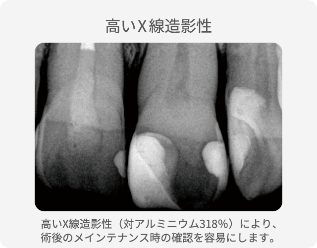 高いX線造影性グラフ