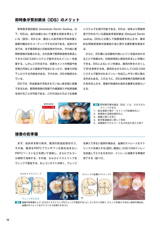 イニシャル LiSi（リジ）ブロック テクノロジーブック