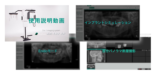 歯科用X線撮影装置のご案内 | 株式会社ジーシー 歯科用X線撮影装置のご案内 | 株式会社ジーシー