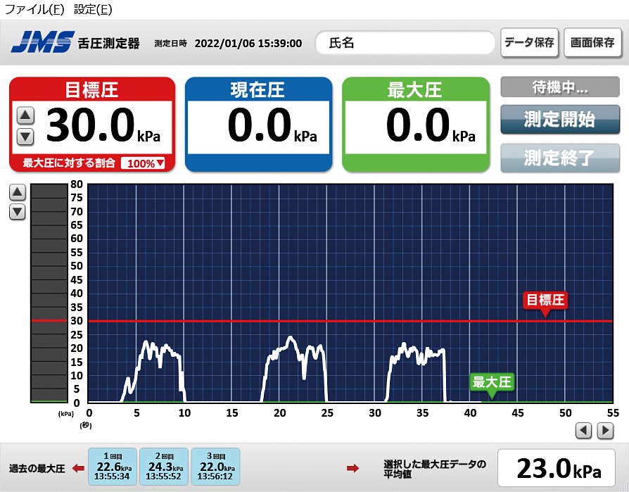 JMS舌圧測定器 測定結果グラフ