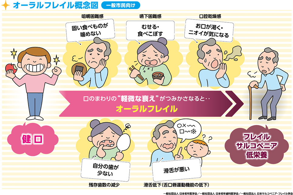 オーラルフレイルをご存じですか？