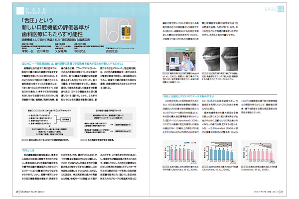 「舌圧」という新しい口腔機能の評価基準が歯科医療にもたらす可能性