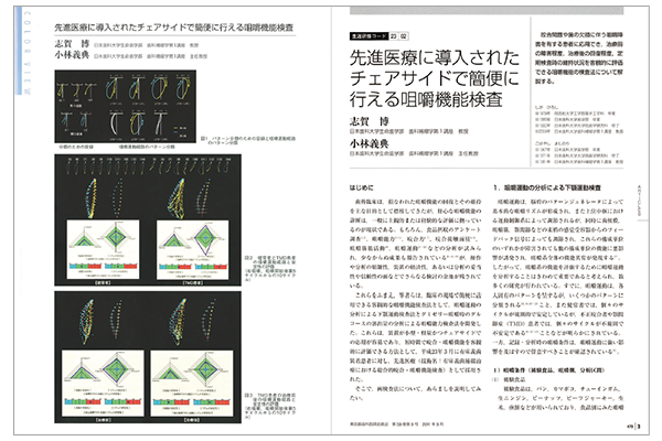 先進医療に導入されたチェアサイドで簡便に行える咀嚼機能検査