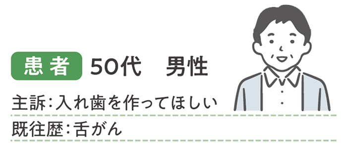 患者 50代 男性