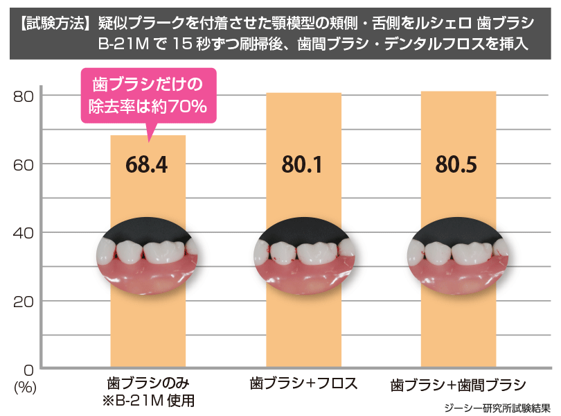 歯間清掃用具のひみつ | ルシェロ（ruscello®） | 株式会社ジーシー