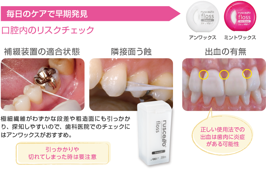 歯間清掃用具のひみつ | ルシェロ（ruscello®） | 株式会社ジーシー