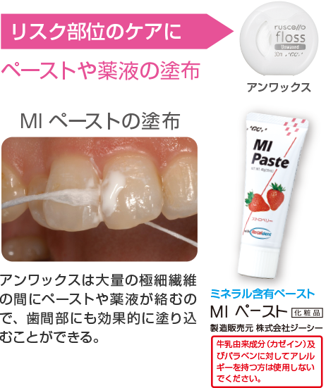 歯間清掃用具のひみつ | ルシェロ（ruscello®） | 株式会社ジーシー