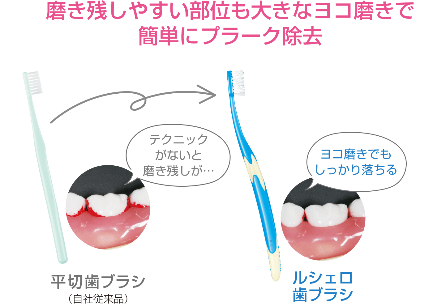 磨き残しやすい部位も大きなヨコ磨きで0簡単にプラーク除去