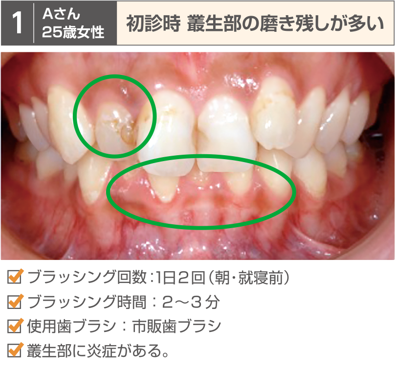 症例1