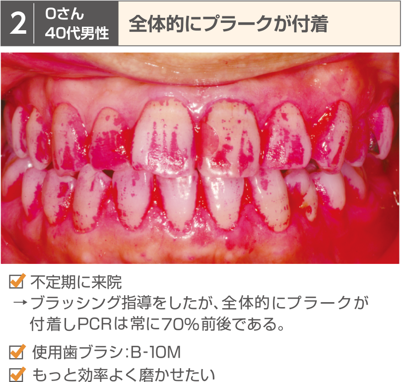 症例2
