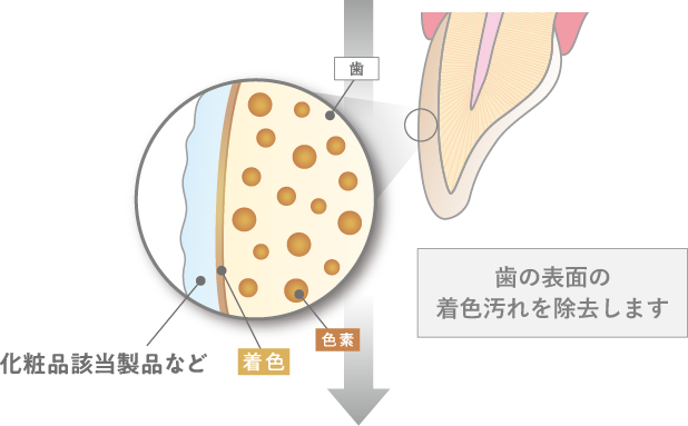 化粧品該当商品など、歯の表面の着色汚れを除去します