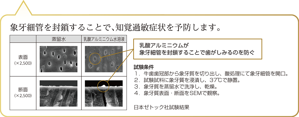 象牙細管を封鎖することで、知覚過敏症状を予防します。