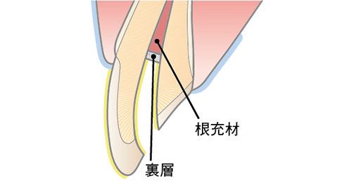 リアクターの準備と塗布